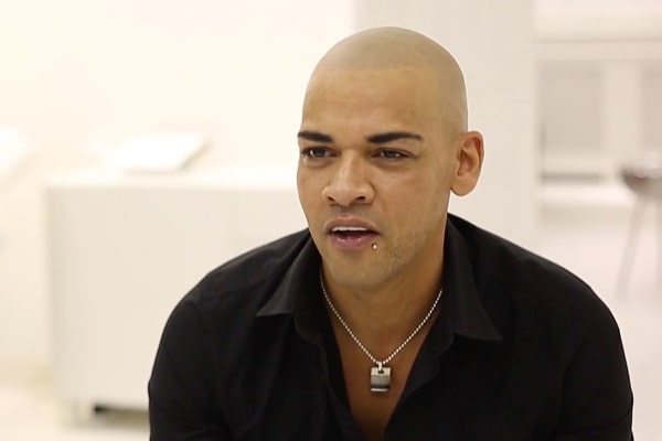 Scalp Micropigmentation Manchester Mike